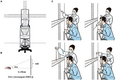 Reduced maximal range of ocular movements and its response to acute levodopa challenge in Parkinson's disease